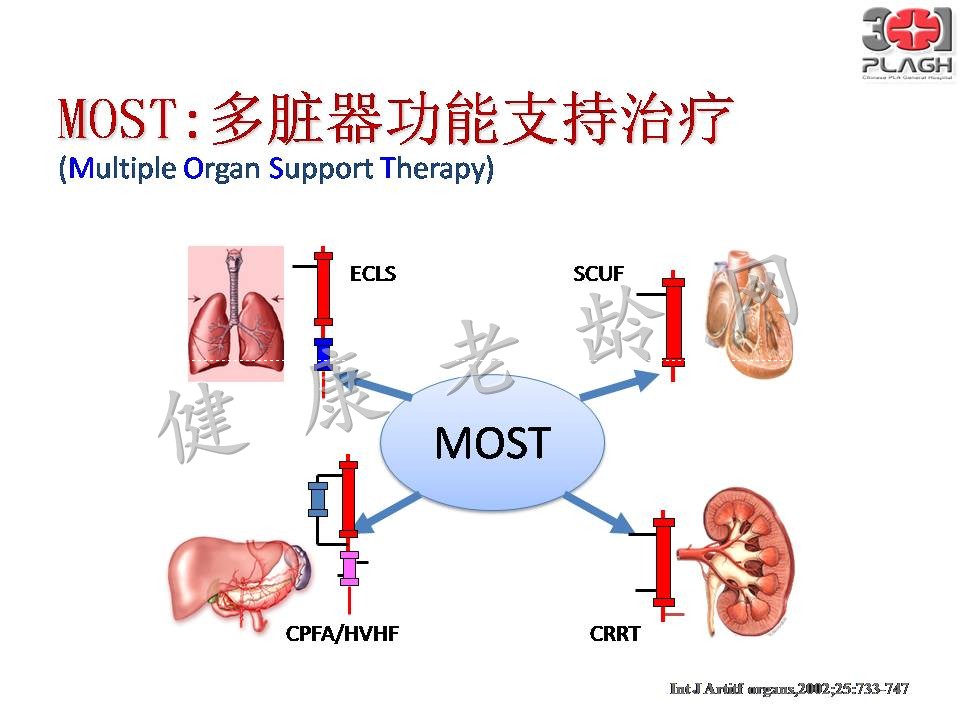 老年多器官衰竭的血液净化治疗