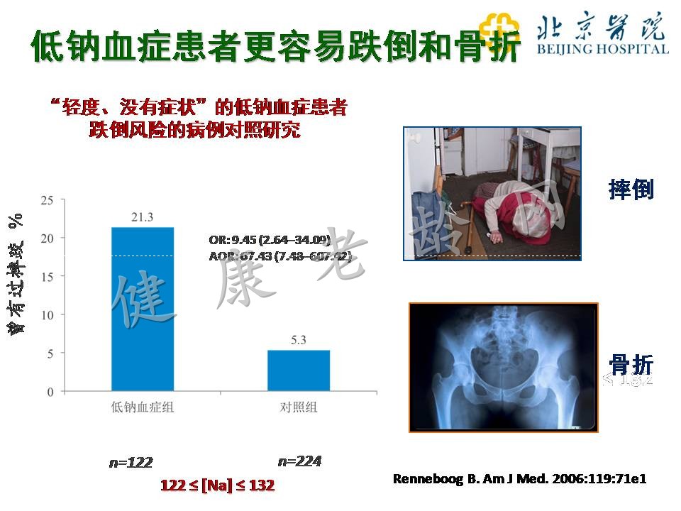 老年患者的低钠血症