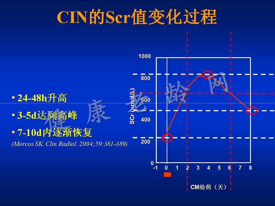 对比剂肾病