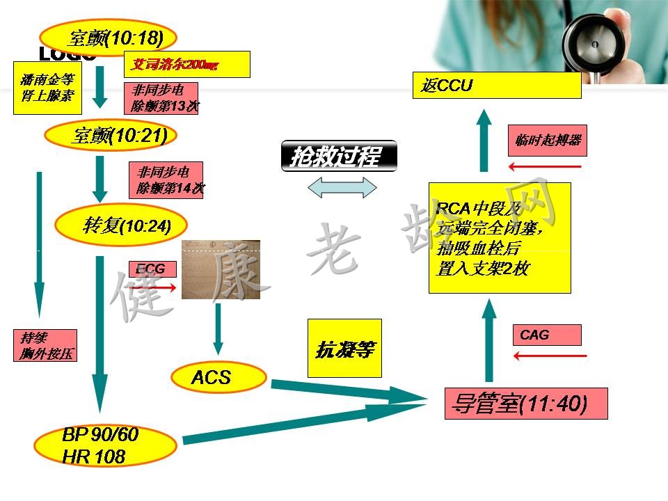 心肺复苏——从理论到实践