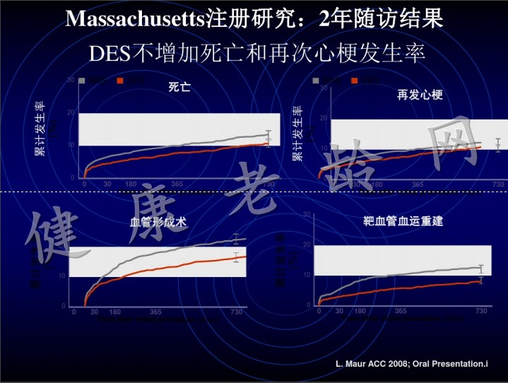 急性心肌梗死的介入治疗