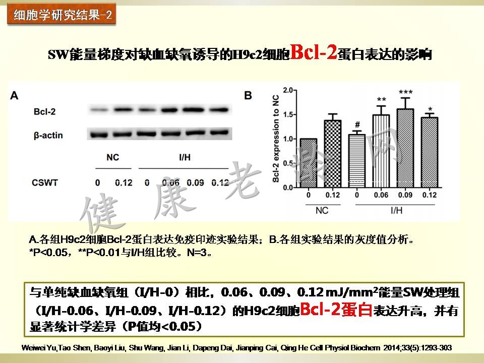 冠心病治疗新方法探讨——体外心脏震波治疗 Cardiac Shock Wave Therapy