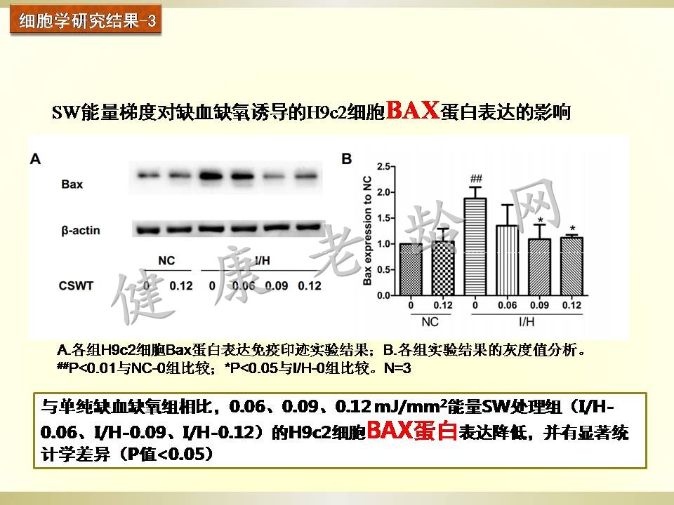 冠心病治疗新方法探讨——体外心脏震波治疗 Cardiac Shock Wave Therapy