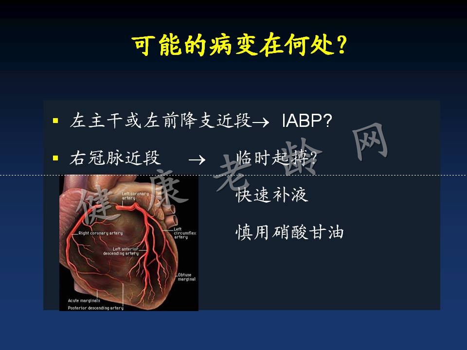 新版指南的主题：分层、抗栓和重建