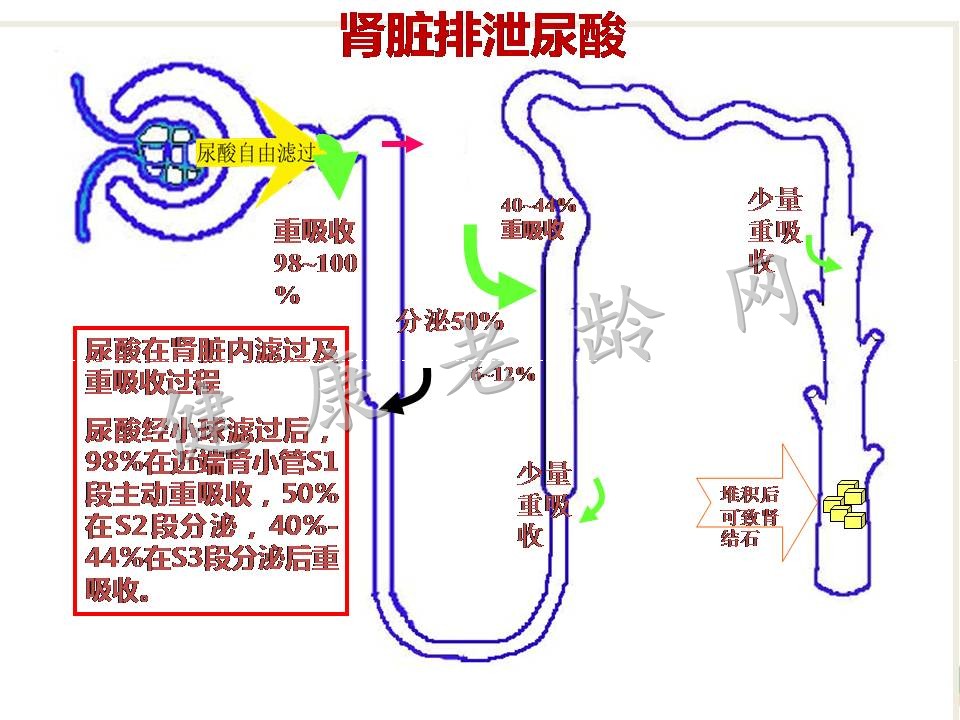 高尿酸血症与肾脏