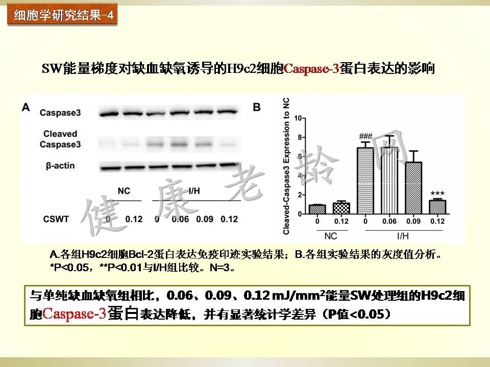 冠心病治疗新方法探讨——体外心脏震波治疗 Cardiac Shock Wave Therapy