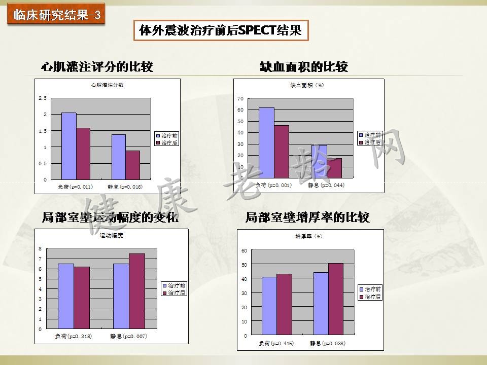 冠心病治疗新方法探讨——体外心脏震波治疗 Cardiac Shock Wave Therapy