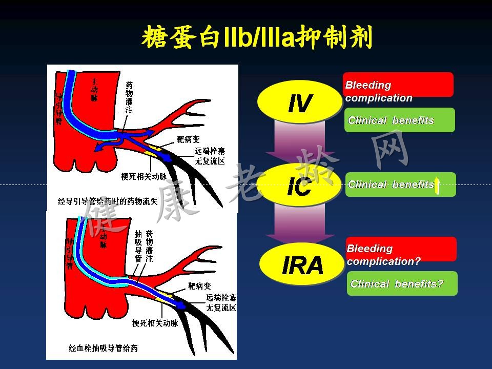 新版指南的主题：分层、抗栓和重建