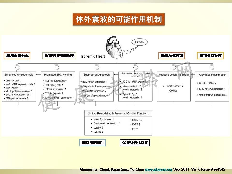 冠心病治疗新方法探讨——体外心脏震波治疗 Cardiac Shock Wave Therapy