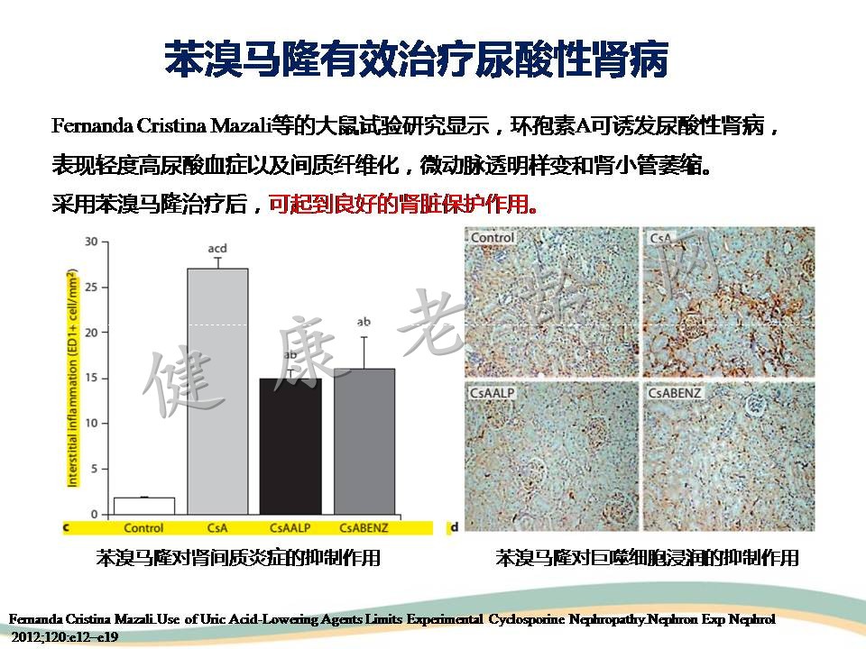 高尿酸血症与肾脏