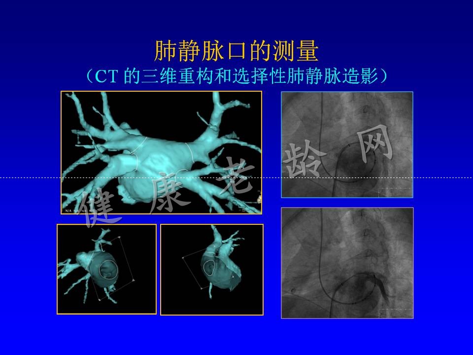 老年房颤患者的治疗