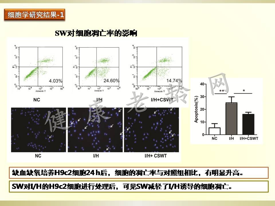 冠心病治疗新方法探讨——体外心脏震波治疗 Cardiac Shock Wave Therapy