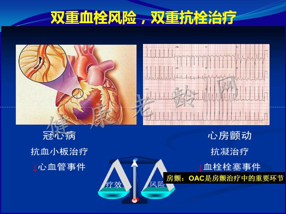 冠心病合并房颤患者抗栓治疗策略