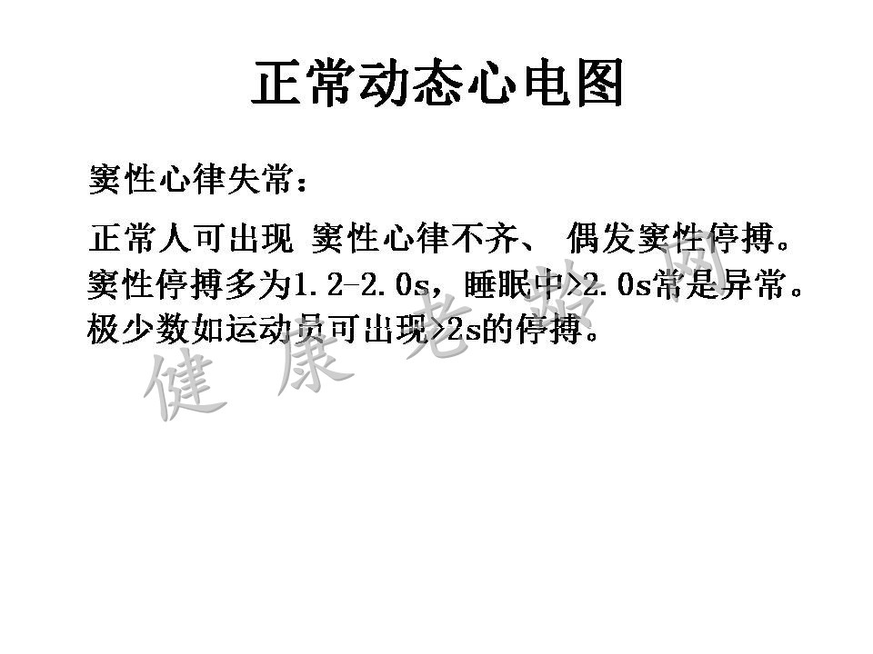 动态心电图