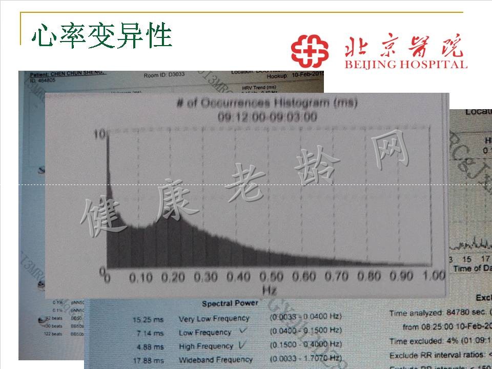 严重直立性低血压一例