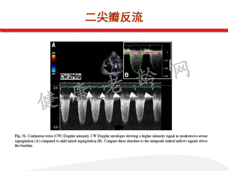 超声心电图的临床基础（一）