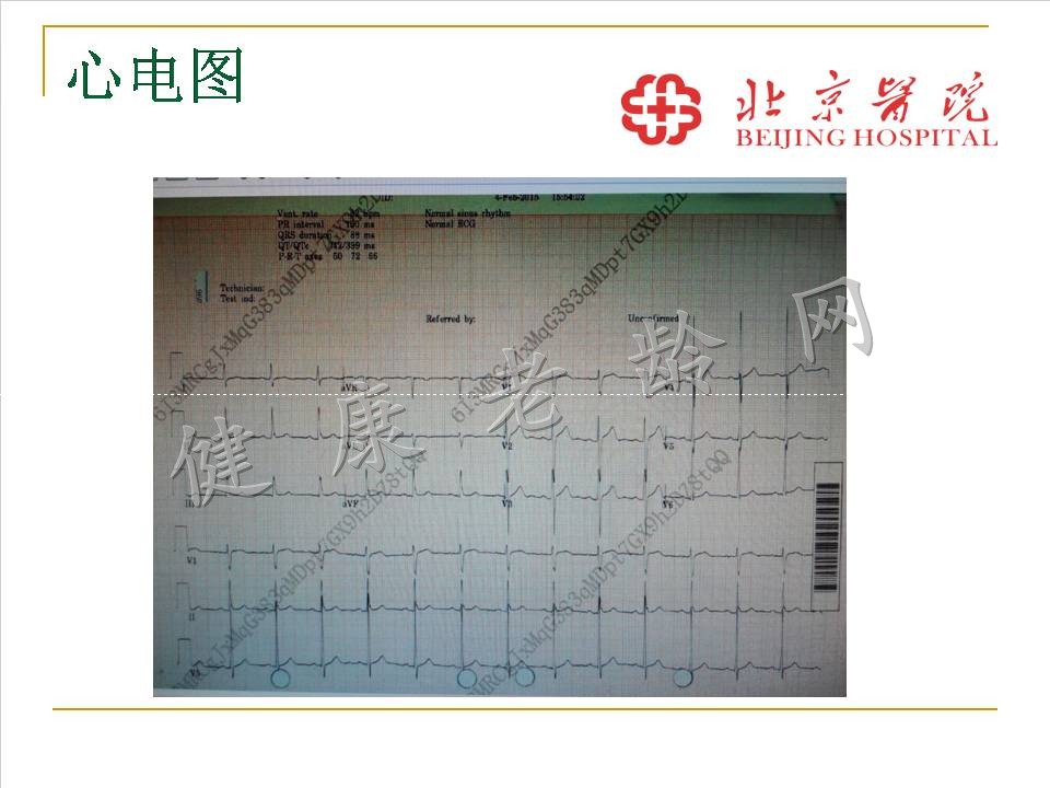 严重直立性低血压一例