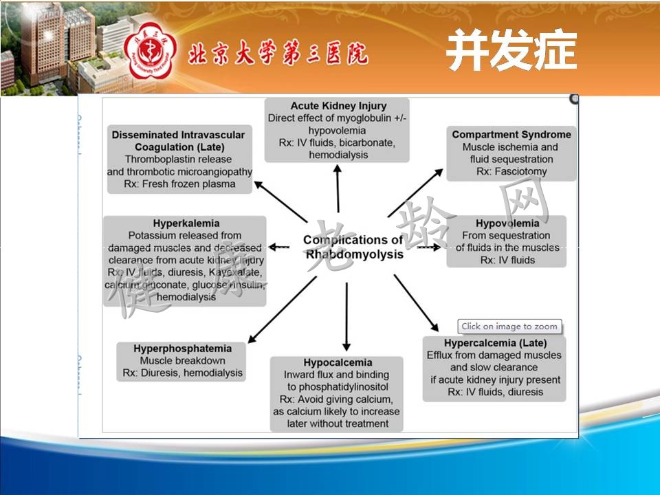 高龄横纹肌溶解并多脏器功能衰竭一例