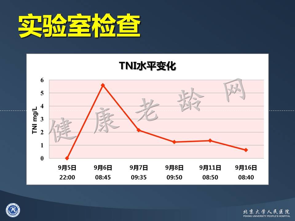 真实病因被忽视的急性心肌梗死