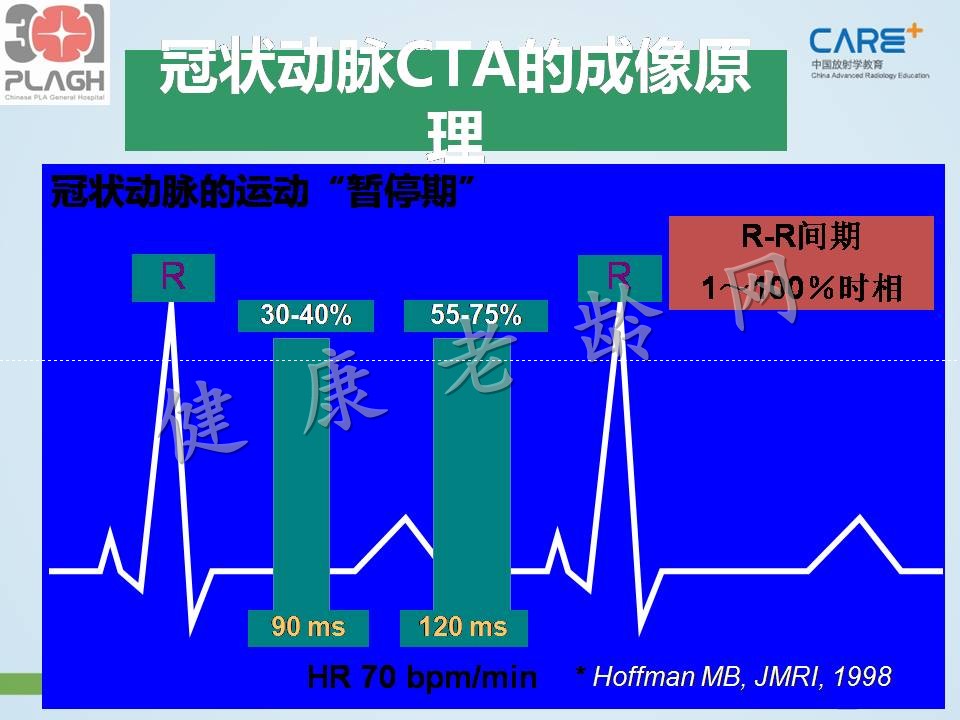 心脏、冠状动脉CT检查（CTA）：判读与意义