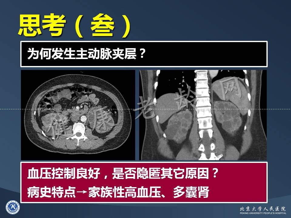 真实病因被忽视的急性心肌梗死