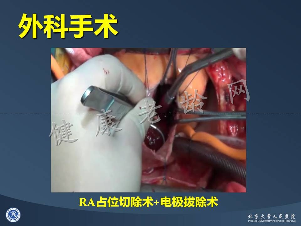心房占位的诊断困境