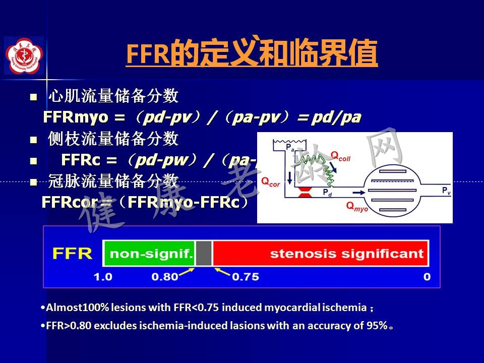 高龄冠心病患者介入治疗——问题思考