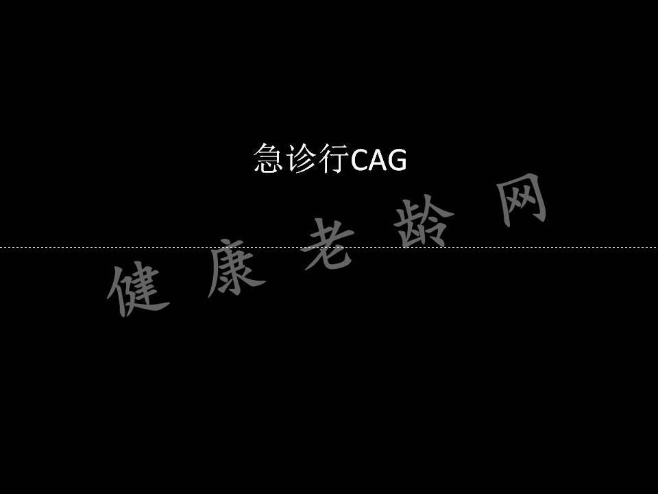 急性心肌梗后心脏破裂