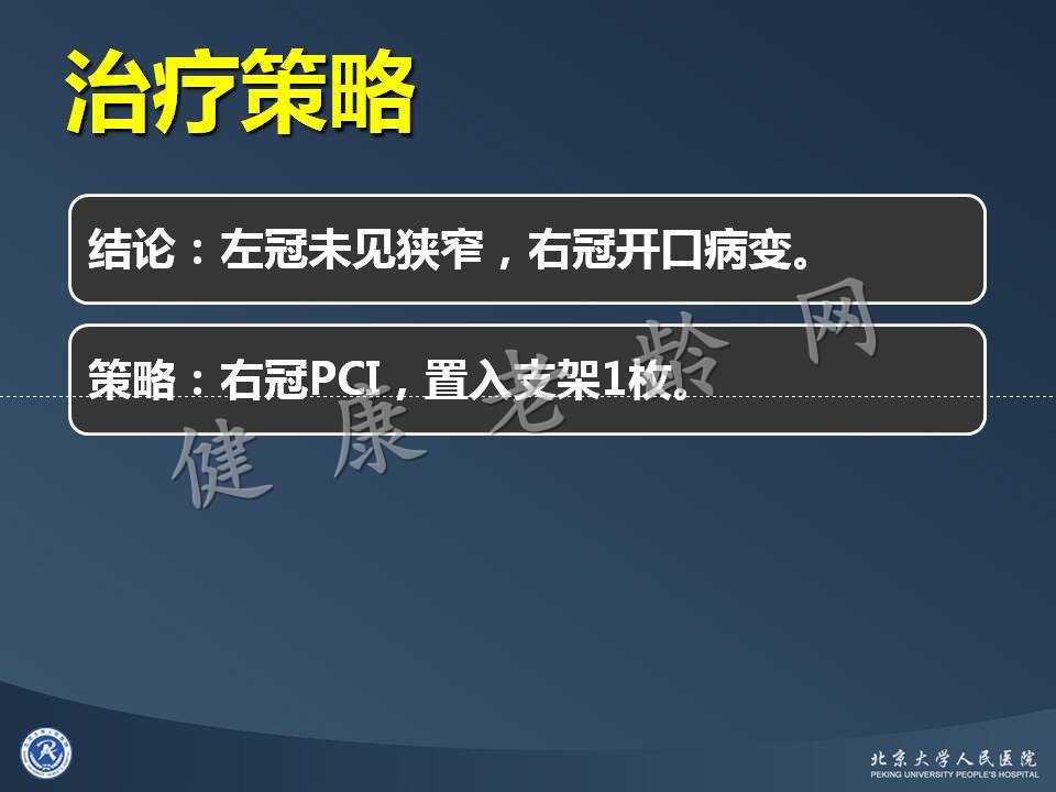 真实病因被忽视的急性心肌梗死