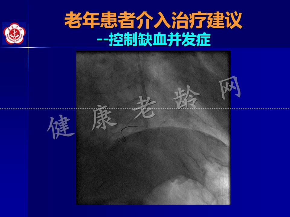 高龄冠心病患者介入治疗——问题思考