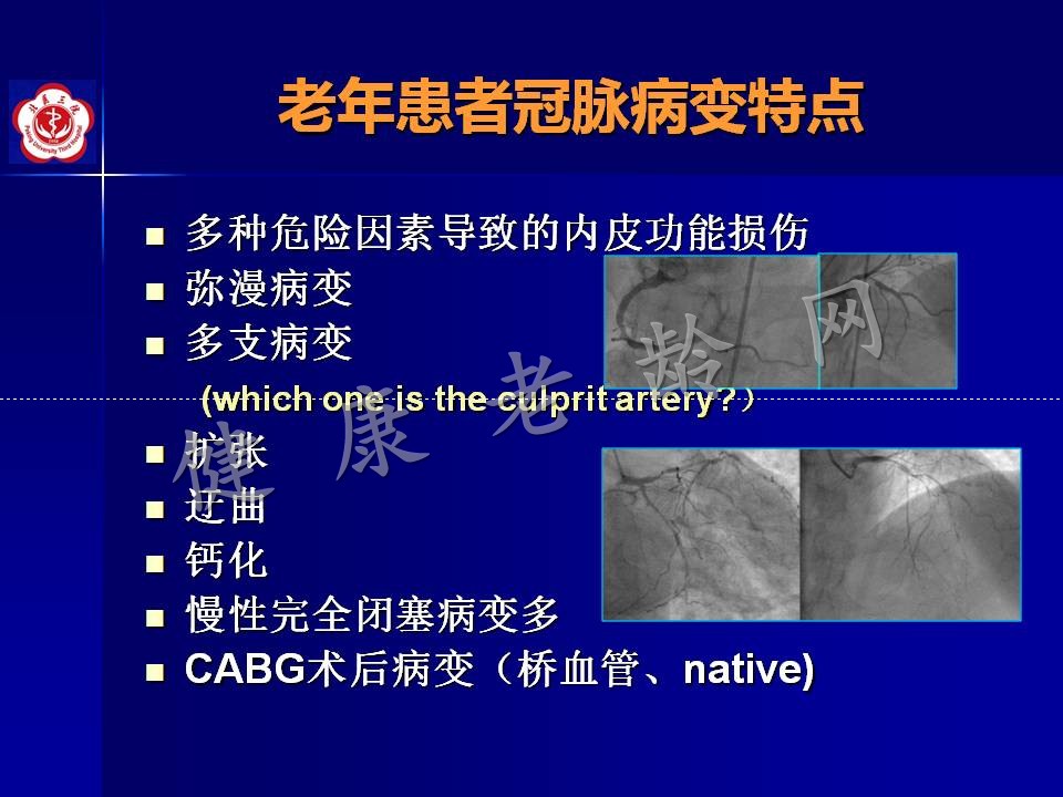 高龄冠心病患者介入治疗——问题思考