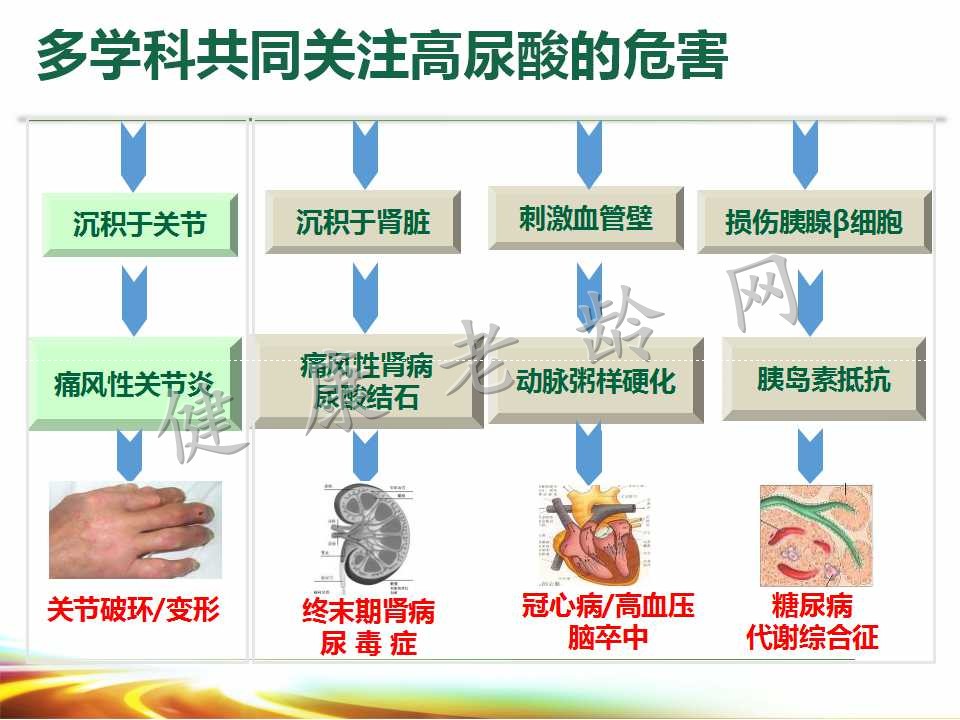 老年人高尿酸血症与痛风的诊治