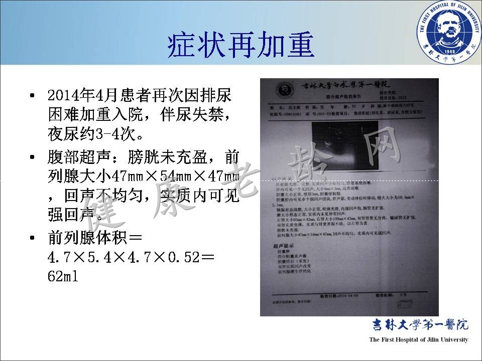 症状控制--LUTS诊疗新模式