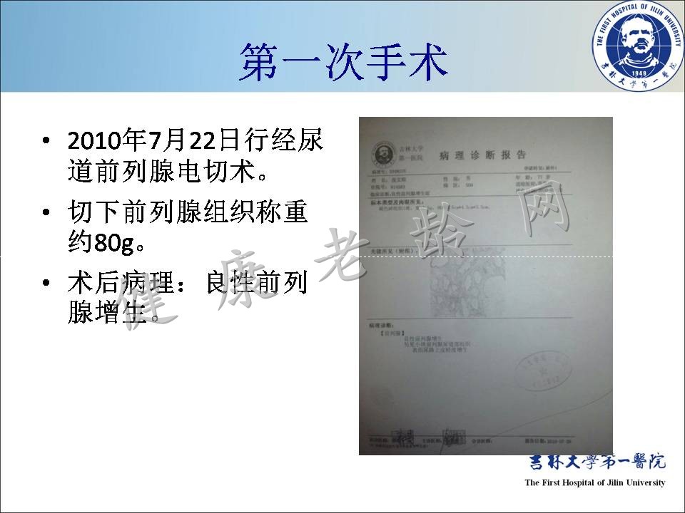 症状控制--LUTS诊疗新模式