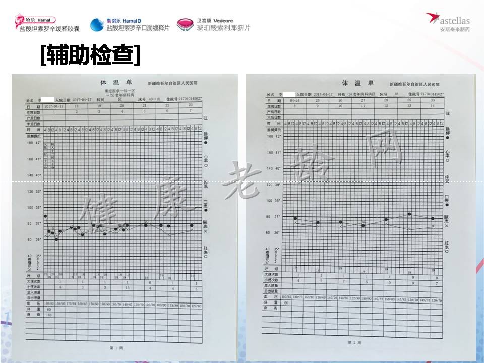 盐酸坦索罗辛在老年LUTS患者中的应用