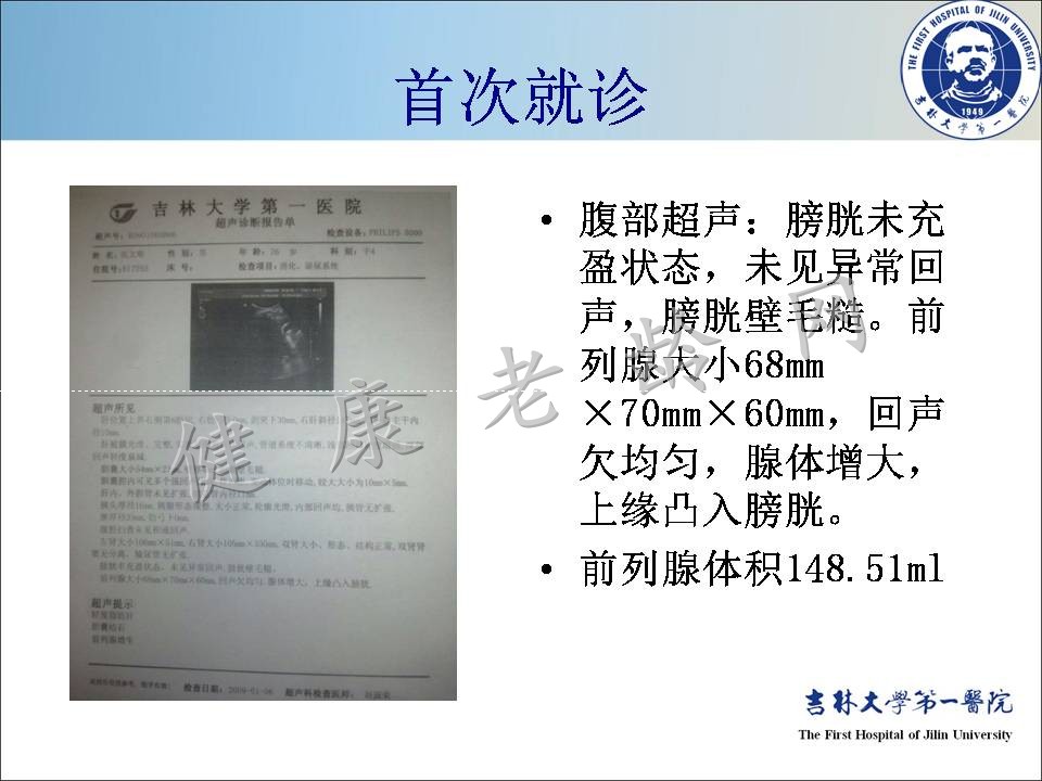 症状控制--LUTS诊疗新模式