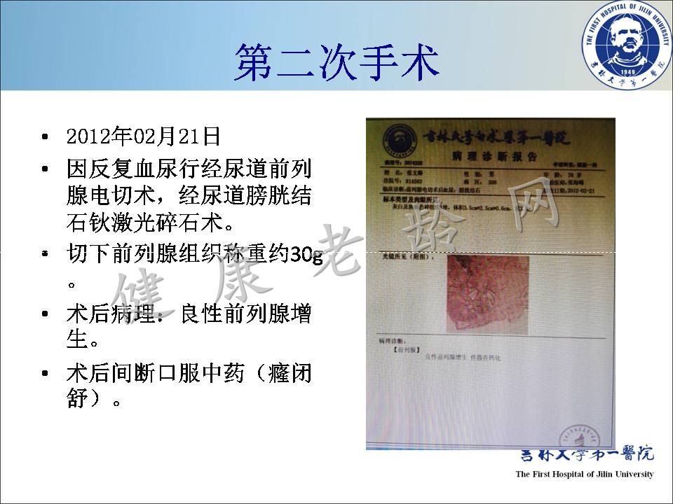 症状控制--LUTS诊疗新模式