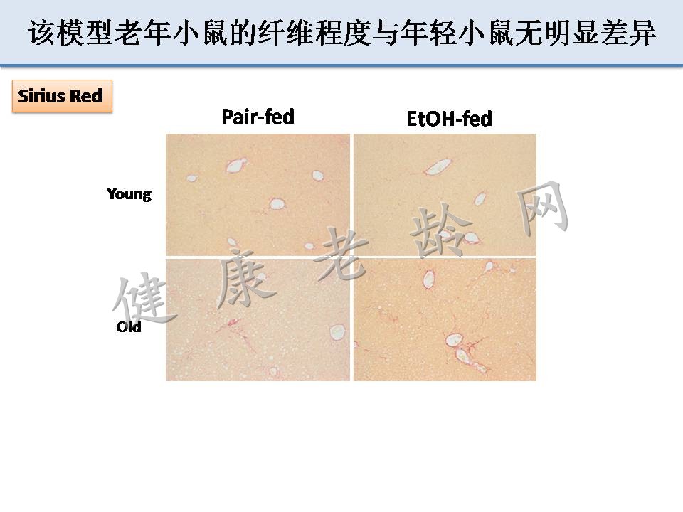 衰老加重酒精性肝损伤和前列腺炎症反应