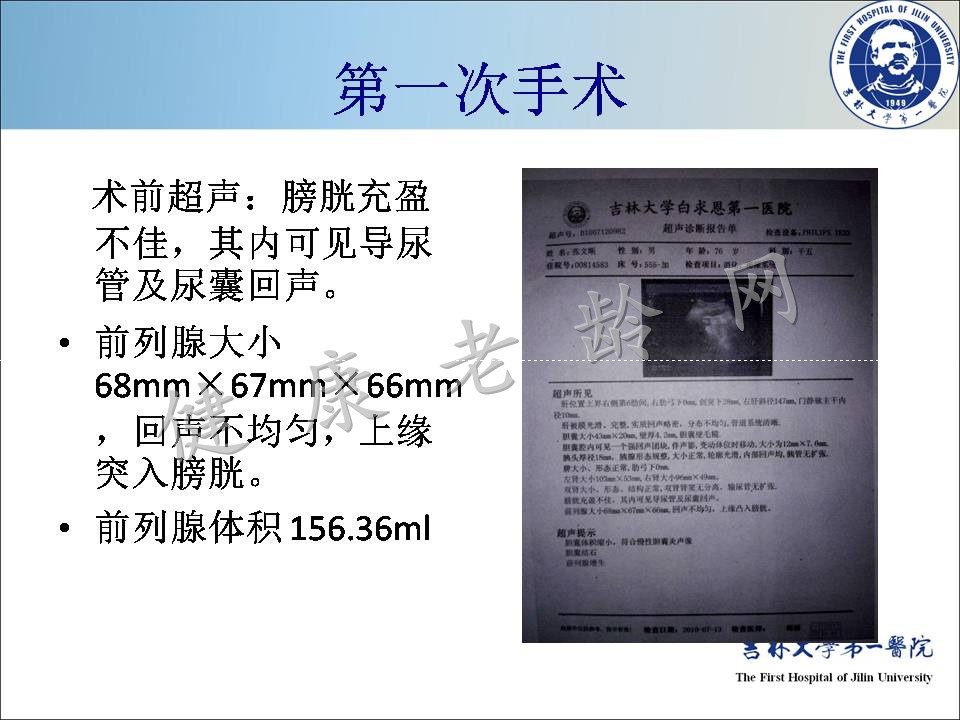 症状控制--LUTS诊疗新模式