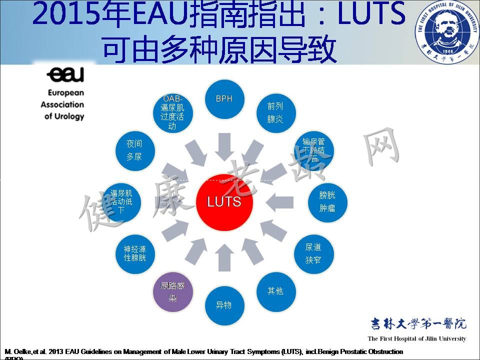 症状控制--LUTS诊疗新模式