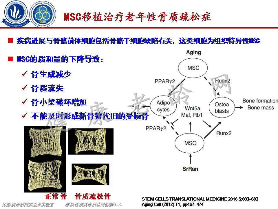 间充质干细胞在老年性疾病治疗中的应用